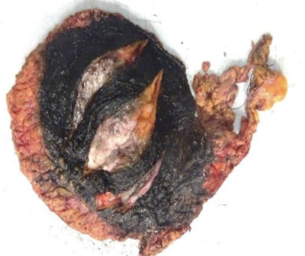 Description of the image